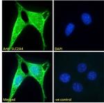 GLUT4 Polyclonal Antibody