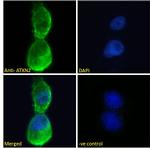 Ataxin 2 Polyclonal Antibody