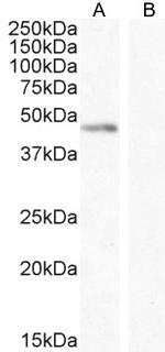 Angiopoietin 1 Antibody in Western Blot (WB)