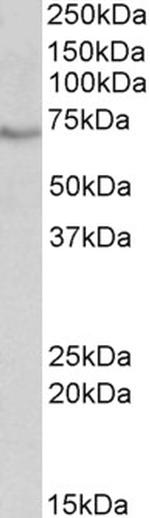 cIAP2 Antibody in Western Blot (WB)