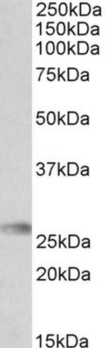 HLA-DQA2 Antibody in Western Blot (WB)