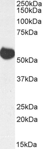 ALDH5A1 Polyclonal Antibody, Biotin