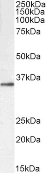 GNB3/GNB4 Polyclonal Antibody, Biotin