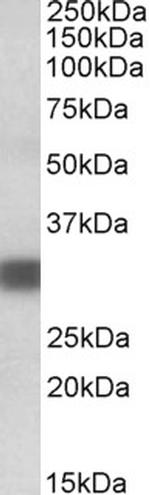 PDXP Antibody in Western Blot (WB)