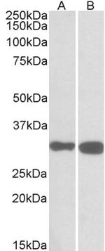 PDXP Antibody in Western Blot (WB)