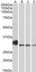 NEK7 Polyclonal Antibody