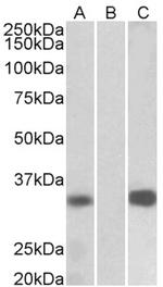 KChIP3 Polyclonal Antibody