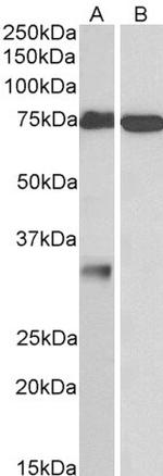 GPM6A Antibody in Western Blot (WB)