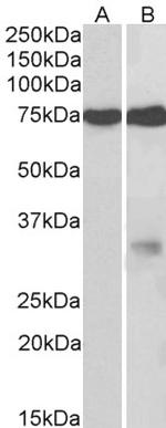GPM6A Antibody in Western Blot (WB)