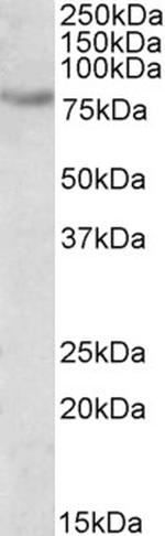 SIM2 Polyclonal Antibody