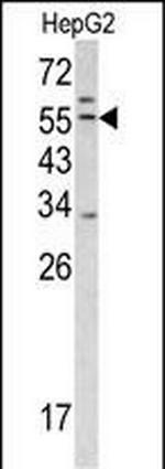 TMPRSS2 Polyclonal Antibody