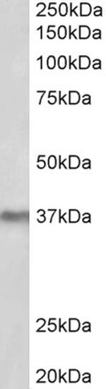 POLDIP2 Antibody in Western Blot (WB)