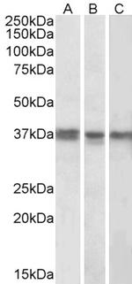 POLDIP2 Polyclonal Antibody