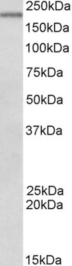 DENND4C Antibody in Western Blot (WB)