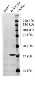 IDH1 Polyclonal Antibody