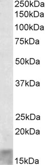 SCOC Polyclonal Antibody