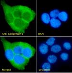 RCAN1 Antibody in Immunocytochemistry (ICC/IF)