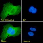 RCAN1 Polyclonal Antibody