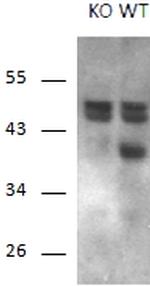 RCAN1 Antibody in Western Blot (WB)