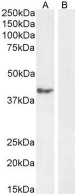 RCAN1 Antibody in Western Blot (WB)