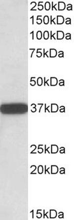 CYB5R3 Antibody in Western Blot (WB)