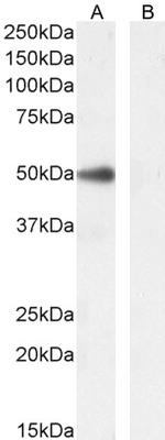 PAX1 Polyclonal Antibody