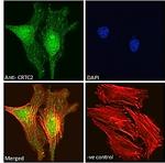 TORC2 Antibody in Immunocytochemistry (ICC/IF)