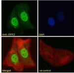TORC2 Polyclonal Antibody