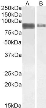 TORC2 Antibody in Western Blot (WB)