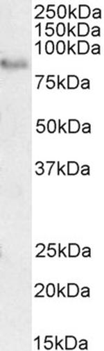 TORC2 Antibody in Western Blot (WB)
