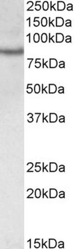 TORC2 Antibody in Western Blot (WB)