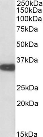 Aspartoacylase Polyclonal Antibody