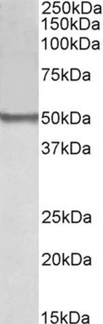 BLK Antibody in Western Blot (WB)