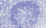 CD28 Antibody in Immunohistochemistry (Paraffin) (IHC (P))