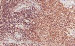 CD28 Antibody in Immunohistochemistry (Paraffin) (IHC (P))
