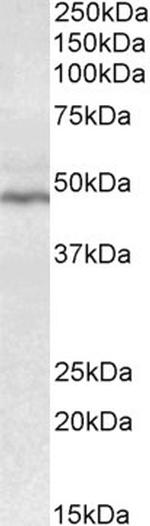 CD28 Antibody in Western Blot (WB)