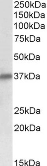 SGCD Antibody in Western Blot (WB)