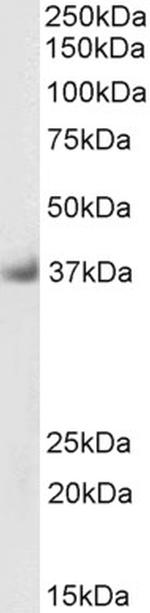 SGCD Polyclonal Antibody, Biotin