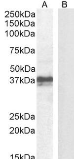 FOXI3 Polyclonal Antibody