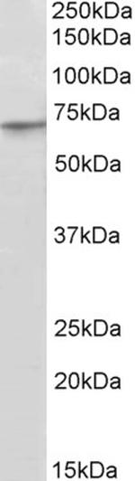 PRDM14 Polyclonal Antibody