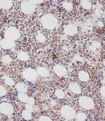 Cathepsin K Polyclonal Antibody