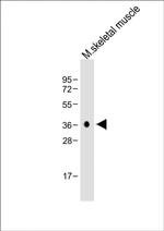 Cathepsin K Antibody in Western Blot (WB)
