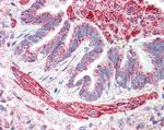 MOB2 Polyclonal Antibody