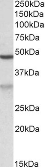 MOB2 Antibody in Western Blot (WB)