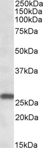 MOB4 Antibody in Western Blot (WB)