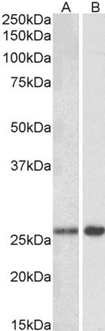 MOB4 Antibody in Western Blot (WB)