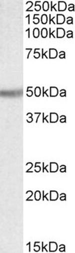 UGT2B Polyclonal Antibody