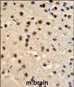 FKBP10 Polyclonal Antibody