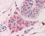 PIM2 Antibody in Immunohistochemistry (Paraffin) (IHC (P))