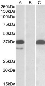 PIM2 Antibody in Western Blot (WB)